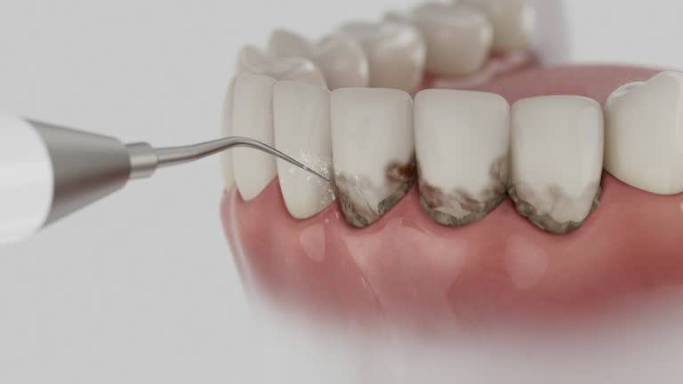 Reliable Wisdom Tooth Removal contractor in Marshall County County, TN by Dentist Open Now